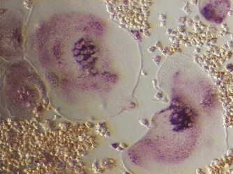 A pair of osteoclasts grown in culture