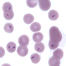 Feline red blood cells infected with Cytauxzoon felis.
