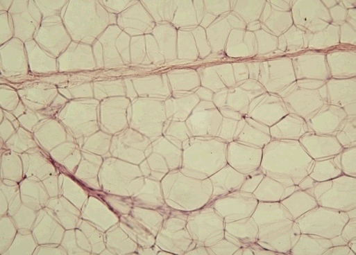 The "honey-comb" structure represents the walls of a group of fat cells