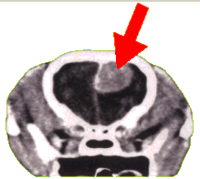 CT Scan of a dog's skull with a meningioma.