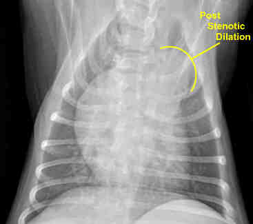 Chest radiograph of a puppy with Pulmonic Stenosis