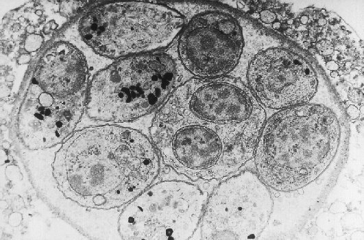 Electron micrograph of a Toxoplasma gondii tissue cyst
