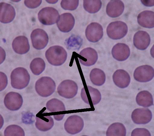 Arrows point to two platelets amid a group of red blood blood cells