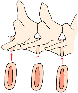 The cut surface of the disk shows the central soft nucleus pulposus and the tougher annulus fibrosus surrounding it. A common analogy is a jelly doughnut.