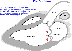 We've highlighted the left side of the heart