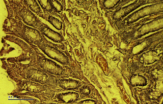 Normal Large Intestine