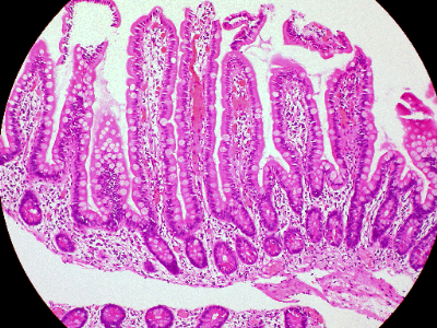 Depiction of the delicate layers of the intestine in health. (Small intestine)