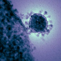 Electron Micrograph of a Coronavirus showing the characteristic halo-like structures for which it is named.