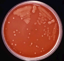 Streptococcus bacteria growing on a blood agar culture plate.