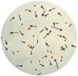 Cultured Clostridium tetani spores Cultured Clostridium tetani spores