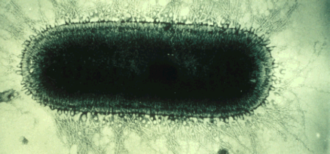 Electron Microscope Image of the Rabies Virus