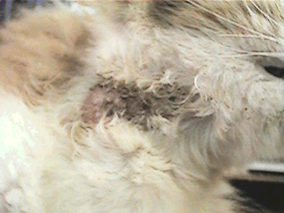 Eosinophilic Granuloma Complex Eosinophilic Granuloma Complex
