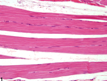Microscopic view of a cross section of skeletal muscle.