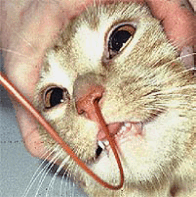 Nasogastric feeding tube