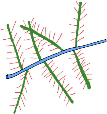 Proteoglycan depiction Proteoglycan depiction