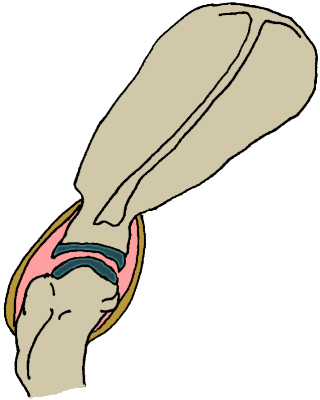 depiction of the shoulder joint depiction of the shoulder joint