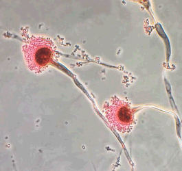 Aspergillus fumigatus under the microscope