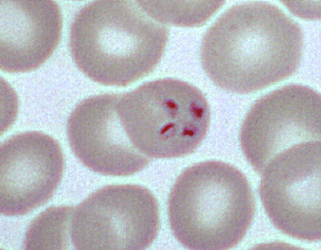 Babesia organisms in an infected red blood cell