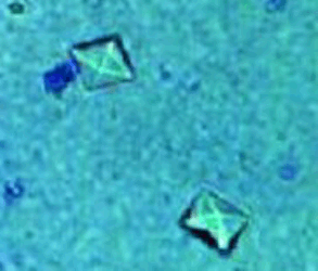 Oxalate crystals 
