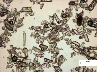 Struvite crystals under the microscope.