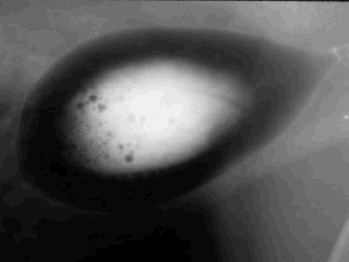 Double contrast cystogram of Dalmatian Double contrast cystogram of Dalmatian