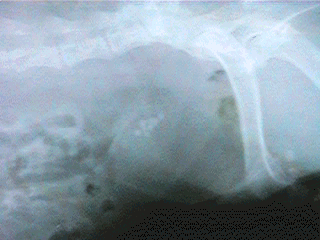 Radiograph showing Oxalate Bladder Stones