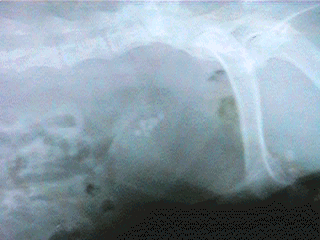 Radiograph showing a urinary bladder full of stones Radiograph showing a urinary bladder full of stones
