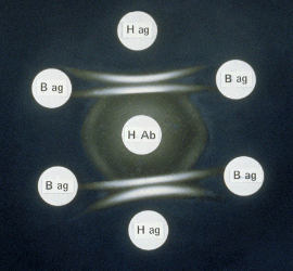 Example of Gel Immunodiffusion