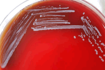 Live culture of Brucella on an agar plate