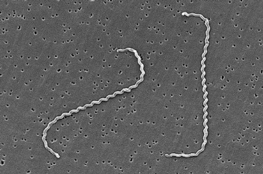 Highly Magnified image of Leptospira spirochetes.