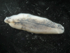 Example of a liver fluke