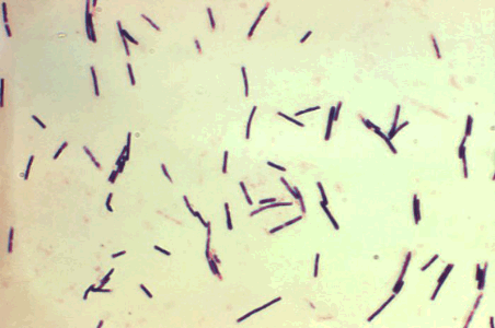Fremskreden solid pinion Clostridium Perfringens - Mar Vista Animal Medical Center