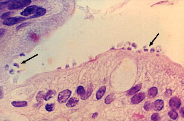 Cryptosporidium organisms attacking intestinal cells