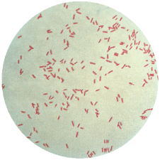 Gram negative bacteria such as Pseudomonas aeruginosa shown