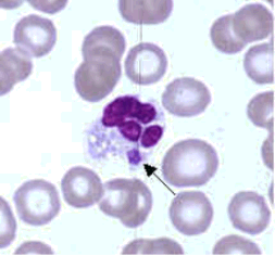 Ehrlichia in a granulcytic cell