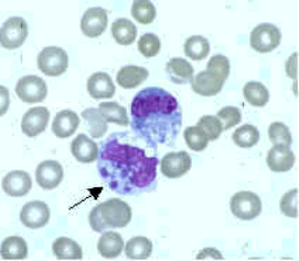 Ehrlichia in a monocytic cell