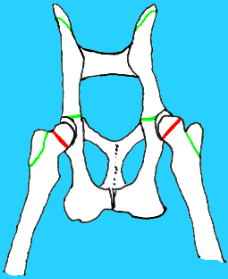 Growth plates are shown in green, except capital physes which are shown in red