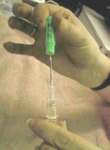 Capping the needle