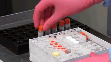 Lab Work Test Tubes