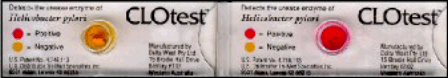 CLO Test