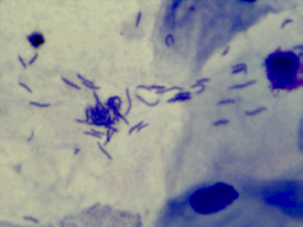 Helicobacter stained