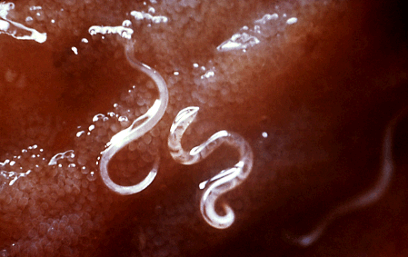 Hookworms attached to the intestinal lining