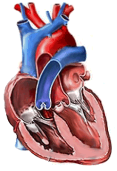 Normal heart with normal heart muscle thickness