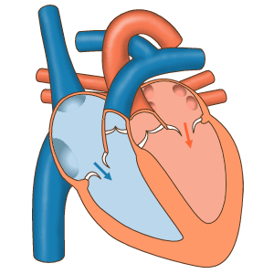 Normal heart filling with and pumping out blood in its normal coordinated fashion.