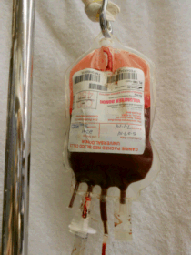 Transfusion bag of blood
