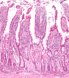 Normal small intestine under the microscope. The finger-like projections are the "microvilli" which are responsible for absorbing nutrients. We want  nutrients to be absorbed in, not leaked out and lost.
