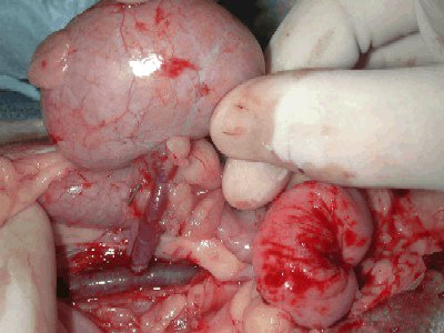 Niere während der Transplantation