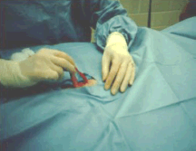 Surgery Prep