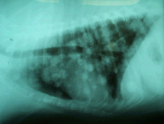 Tumor spread 