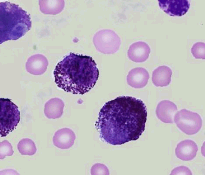 Mast cells stain
